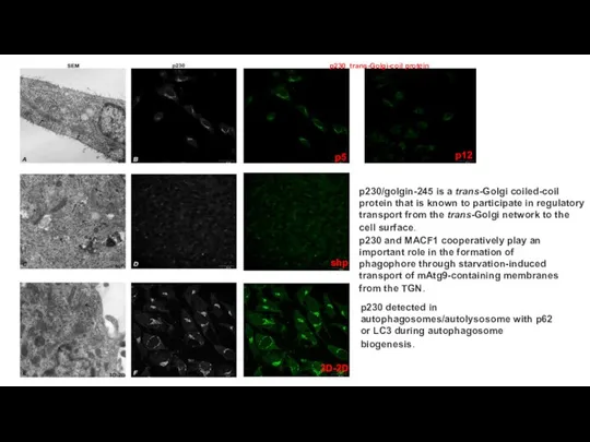 p12 p230 trans-Golgi-coil protein p5 3D-2D shp p230/golgin-245 is a trans-Golgi coiled-coil