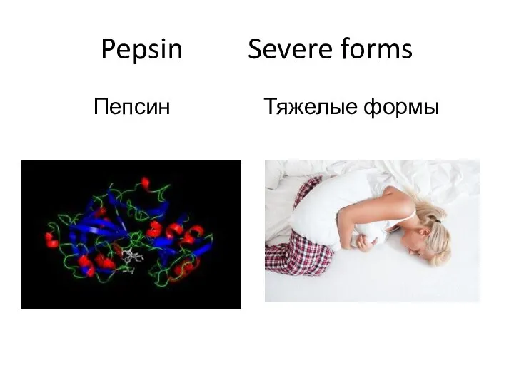 Pepsin Severe forms Пепсин Тяжелые формы
