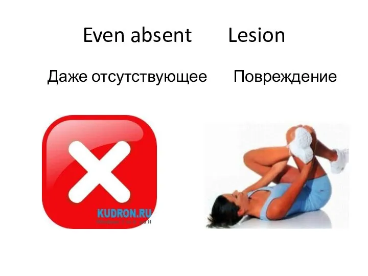 Even absent Lesion Даже отсутствующее Повреждение