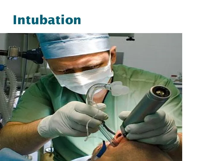 Intubation