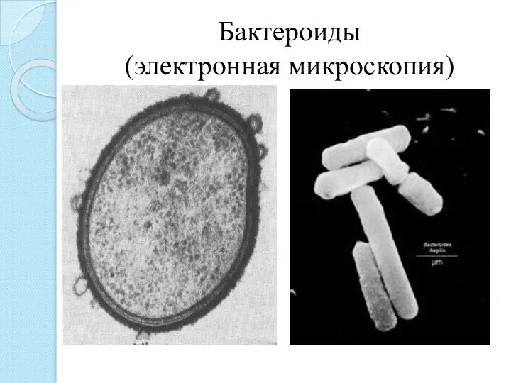 Бактероиды (электронная микроскопия)