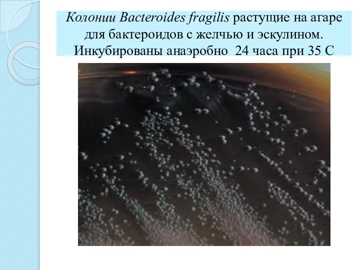 Колонии Bacteroides fragilis растущие на агаре для бактероидов с желчью и эскулином.