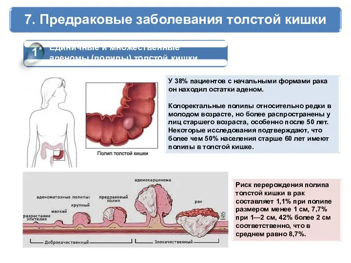 7. Предраковые заболевания толстой кишки 1 Единичные и множественные аденомы (полипы) толстой