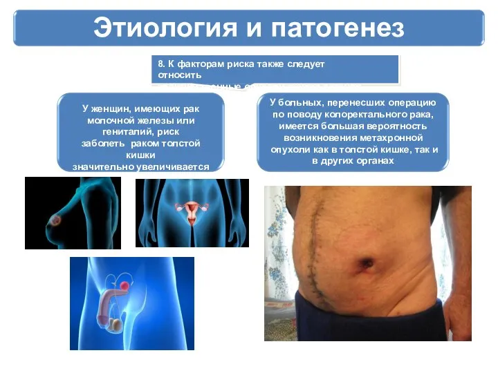 Этиология и патогенез 8. К факторам риска также следует относить злокачественные опухоли