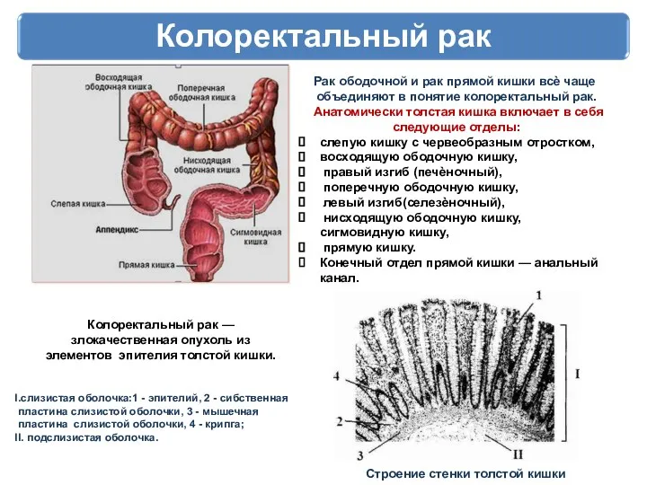 Колоректальный рак Рак ободочной и рак прямой кишки всѐ чаще объединяют в