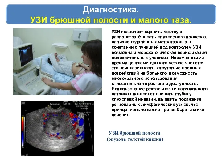 Диагностика. УЗИ брюшной полости и малого таза. УЗИ позволяет оценить местную распространѐнность