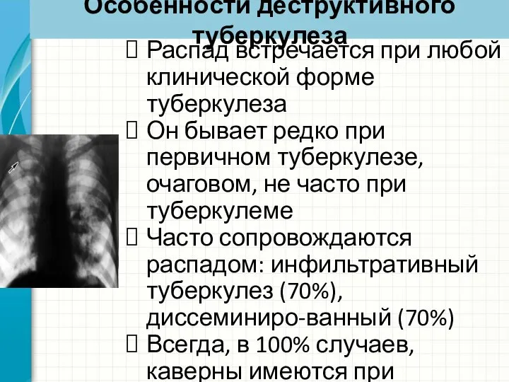 Особенности деструктивного туберкулеза Распад встречается при любой клинической форме туберкулеза Он бывает