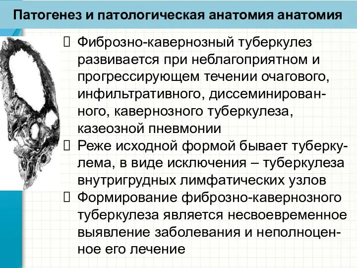 Патогенез и патологическая анатомия анатомия Фиброзно-кавернозный туберкулез развивается при неблагоприятном и прогрессирующем