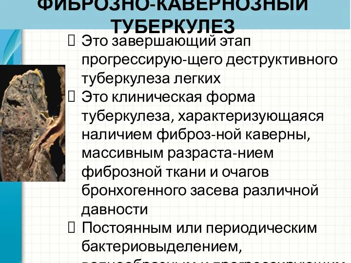 ФИБРОЗНО-КАВЕРНОЗНЫЙ ТУБЕРКУЛЕЗ Это завершающий этап прогрессирую-щего деструктивного туберкулеза легких Это клиническая форма