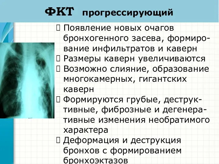 ФКТ прогрессирующий Появление новых очагов бронхогенного засева, формиро-вание инфильтратов и каверн Размеры