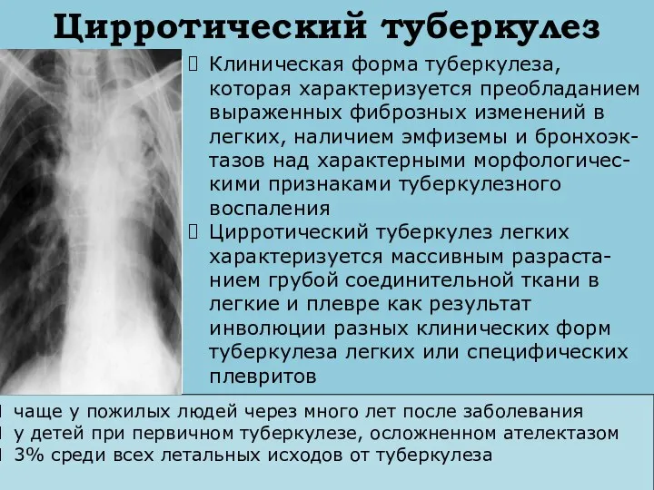 Цирротический туберкулез Клиническая форма туберкулеза, которая характеризуется преобладанием выраженных фиброзных изменений в