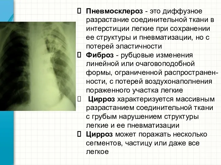 Пневмосклероз - это диффузное разрастание соединительной ткани в интерстиции легкие при сохранении