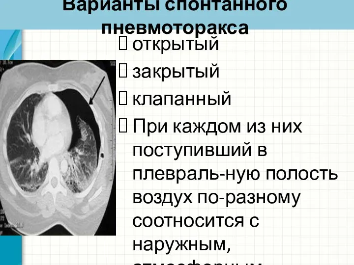 Варианты спонтанного пневмоторакса открытый закрытый клапанный При каждом из них поступивший в