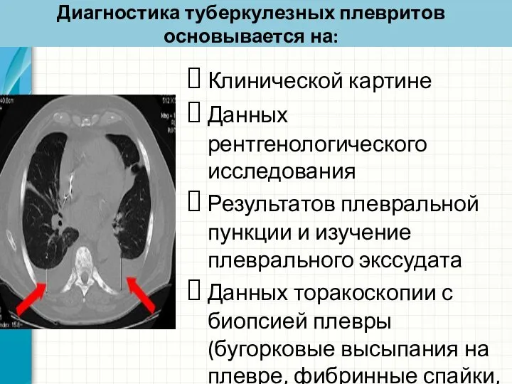 Диагностика туберкулезных плевритов основывается на: Клинической картине Данных рентгенологического исследования Результатов плевральной