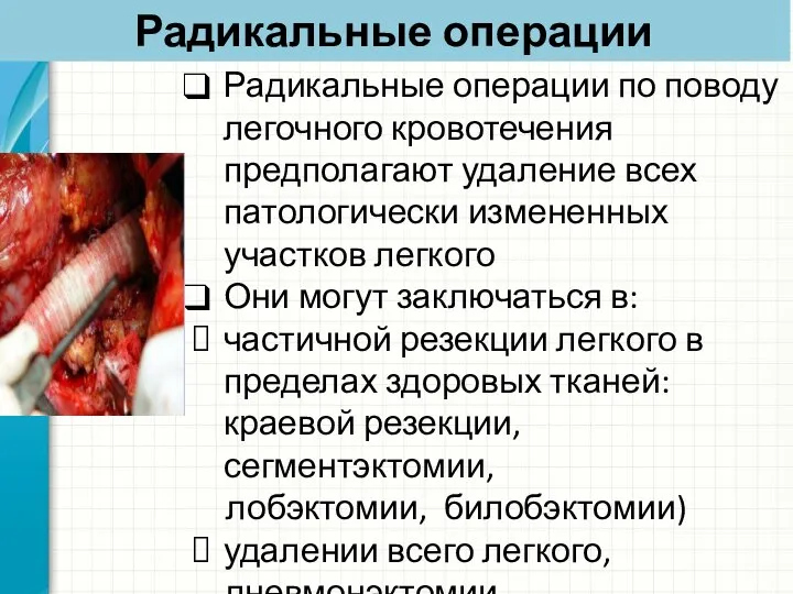 Радикальные операции Радикальные операции по поводу легочного кровотечения предполагают удаление всех патологически