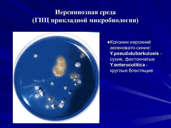 Иерсиниозная среда (ГНЦ прикладной микробиологии) Колонии иерсиний зеленовато-синие: Y.pseudotuberkulosis - сухие, фестончатые Y.enterocolitica - круглые блестящие