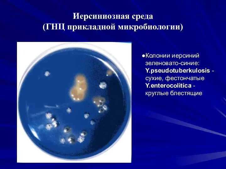 Колония это микробиология. Иерсинии на среде Серова. Среды для иерсиний. Колонии иерсиний.
