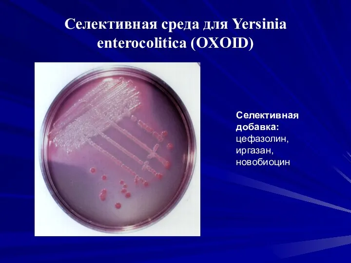 Селективная среда для Yersinia enterocolitica (OXOID) Селективная добавка: цефазолин, иргазан, новобиоцин