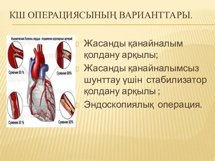 КШ ОПЕРАЦИЯСЫНЫҢ ВАРИАНТТАРЫ. Жасанды қанайналым қолдану арқылы; Жасанды қанайналымсыз шунттау үшін стабилизатор