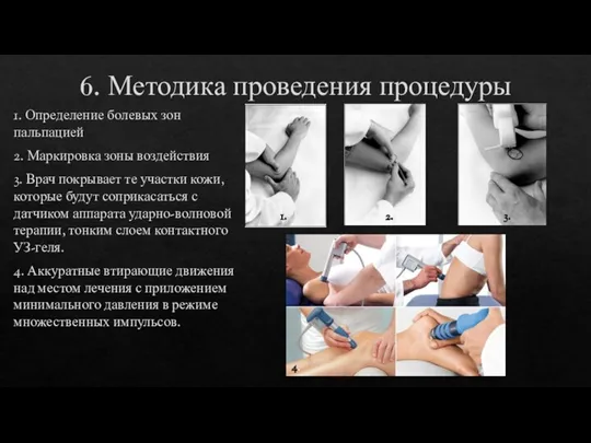 6. Методика проведения процедуры 1. Определение болевых зон пальпацией 2. Маркировка зоны