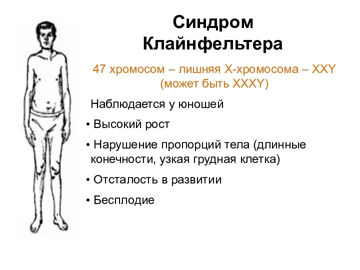 Синдром Клайнфельтера 47 хромосом – лишняя Х-хромосома – ХХY (может быть ХХХY)