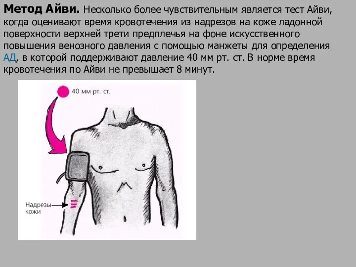 Метод Айви. Несколько более чувствительным является тест Айви, когда оценивают время кровотечения