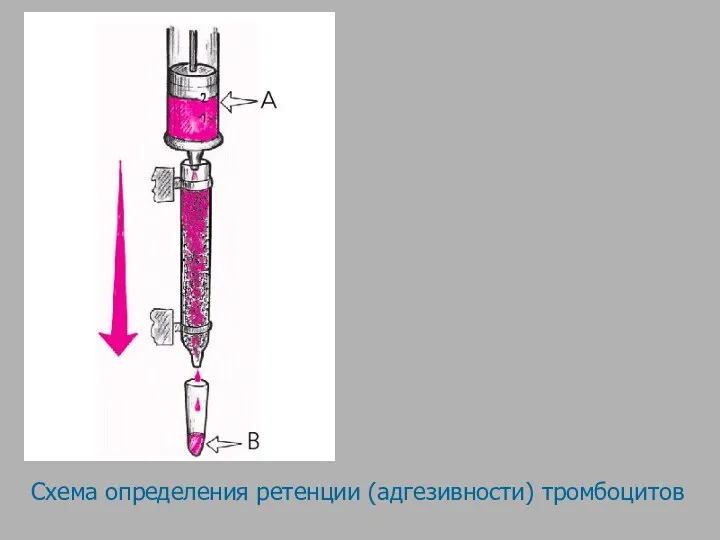 Схема определения ретенции (адгезивности) тромбоцитов