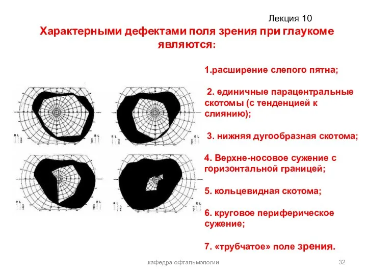 Характерными дефектами поля зрения при глаукоме являются: кафедра офтальмологии 1.расширение слепого пятна;