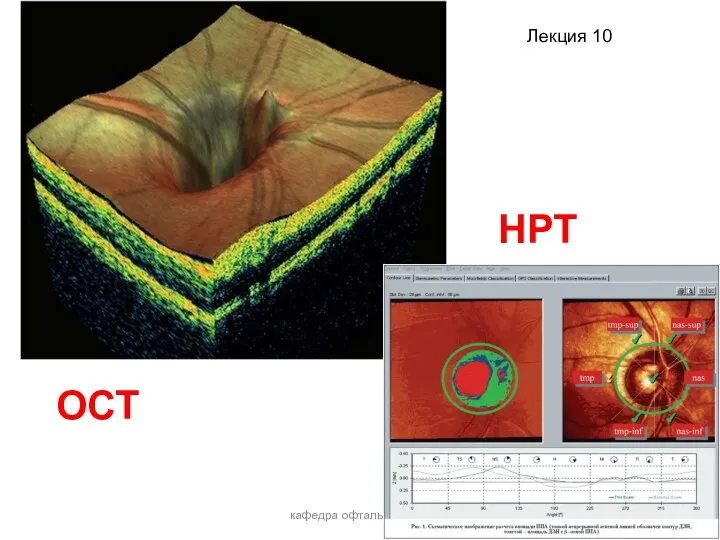кафедра офтальмологии ОСТ НРТ