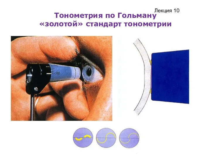 Тонометрия по Гольману «золотой» стандарт тонометрии