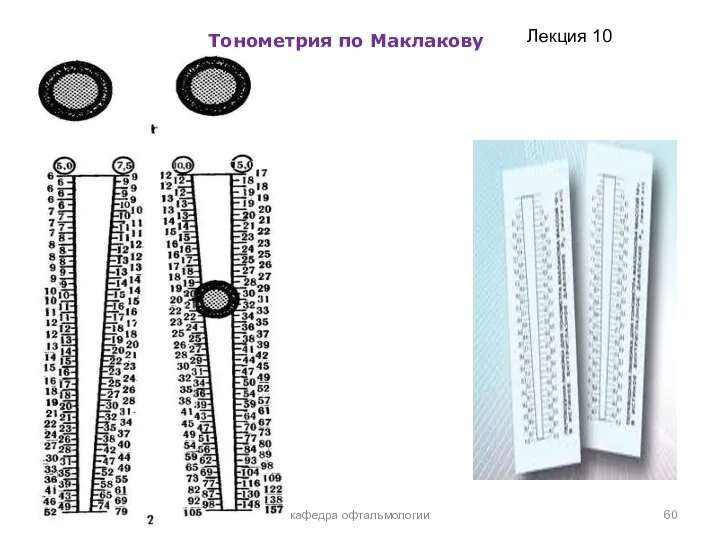 Тонометрия по Маклакову кафедра офтальмологии