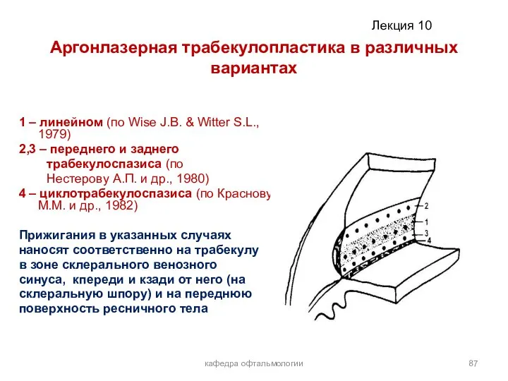 кафедра офтальмологии Аргонлазерная трабекулопластика в различных вариантах 1 – линейном (по Wise