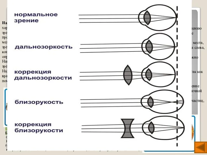 Нарушение зрения Близорукость Близорукость - вид клинической рефракции, при которой преломляющая сила