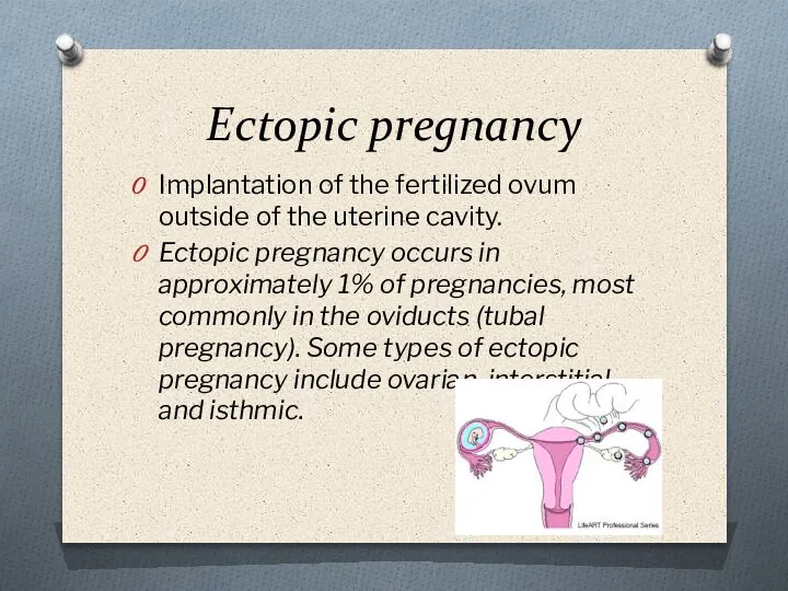 Ectopic pregnancy Implantation of the fertilized ovum outside of the uterine cavity.