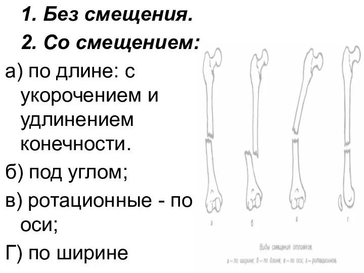 1. Без смещения. 2. Со смещением: а) по длине: с укорочением и