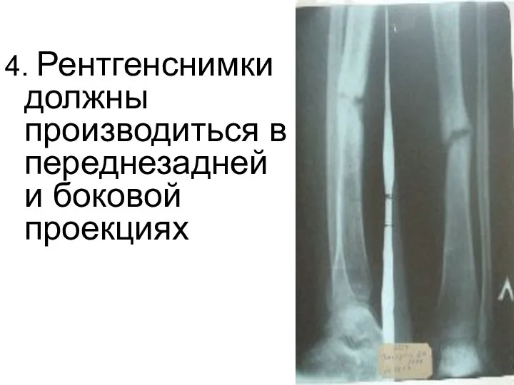 4. Рентгенснимки должны производиться в переднезадней и боковой проекциях