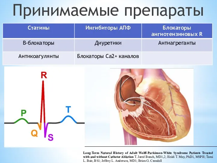 Принимаемые препараты Long-Term Natural History of Adult Wolff-Parkinson-White Syndrome Patients Treated with