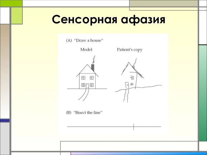 Сенсорная афазия