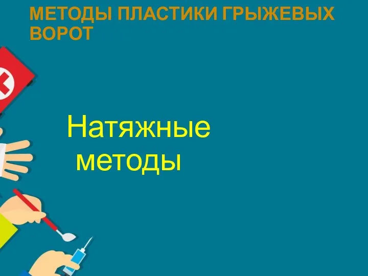 МЕТОДЫ ПЛАСТИКИ ГРЫЖЕВЫХ ВОРОТ Натяжные методы