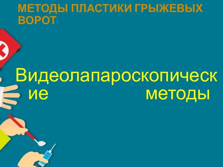 МЕТОДЫ ПЛАСТИКИ ГРЫЖЕВЫХ ВОРОТ Видеолапароскопические методы