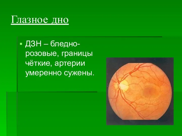 Глазное дно ДЗН – бледно-розовые, границы чёткие, артерии умеренно сужены.