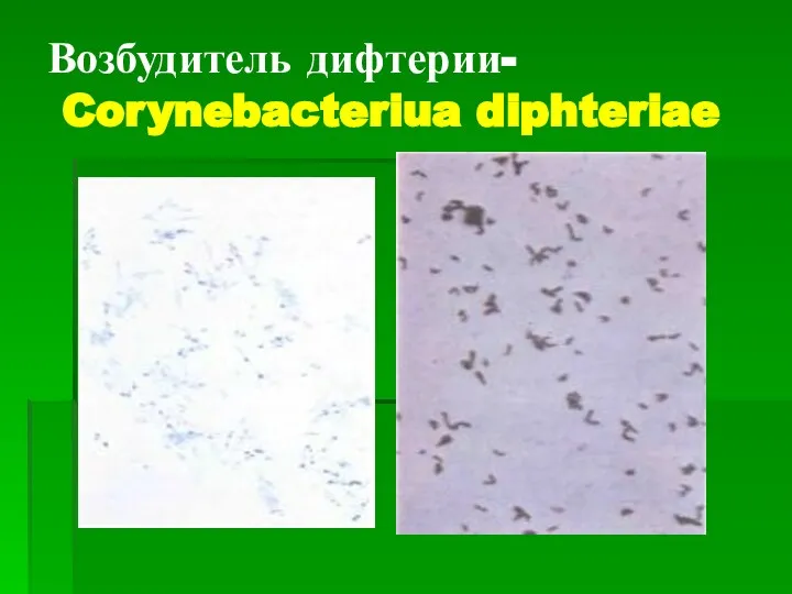 Возбудитель дифтерии- Corynebacteriua diphteriae