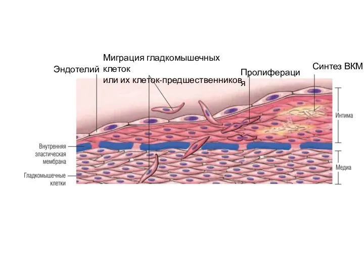 Эндотелий Миграция гладкомышечных клеток или их клеток-предшественников Пролиферация Синтез ВКМ