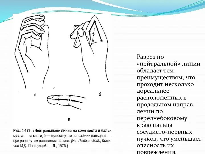 Разрез по «нейтральной» линии обладает тем преимуществом, что проходит несколько дорсальиее расположенных