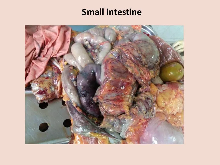 Small intestine