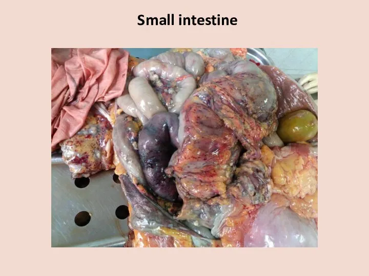 Small intestine