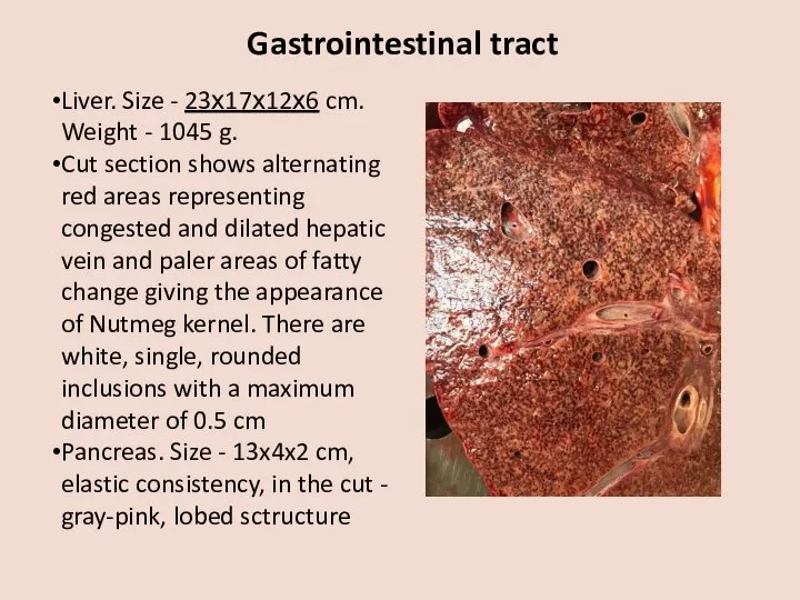 Gastrointestinal tract Liver. Size - 23х17х12х6 cm. Weight - 1045 g. Cut