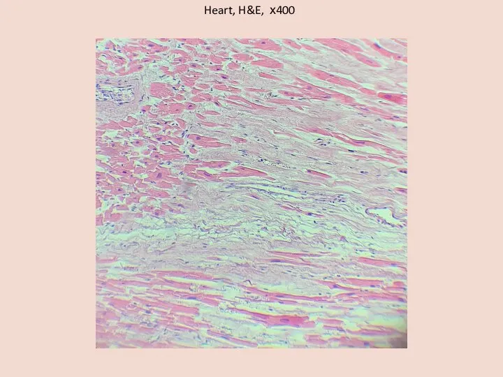 Heart, H&E, х400