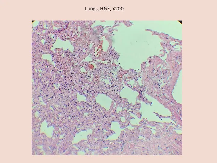 Lungs, H&E, х200