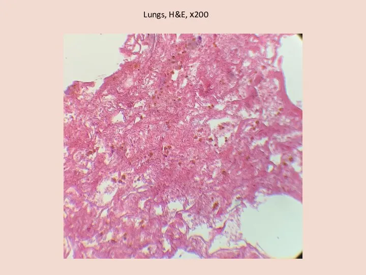 Lungs, H&E, х200